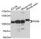 Peroxisomal Biogenesis Factor 6 antibody, abx126351, Abbexa, Western Blot image 
