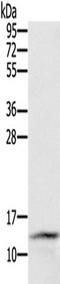 Cystatin SA antibody, TA349861, Origene, Western Blot image 