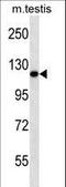 Endoplasmic Reticulum To Nucleus Signaling 2 antibody, LS-C164383, Lifespan Biosciences, Western Blot image 