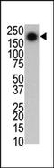 Leucine Rich Repeat Kinase 2 antibody, AM11056PU-N, Origene, Western Blot image 