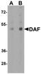 CD55 Molecule (Cromer Blood Group) antibody, NBP2-41295, Novus Biologicals, Western Blot image 