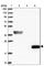 Complement C8 Gamma Chain antibody, HPA046269, Atlas Antibodies, Western Blot image 