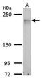 CDC42 Binding Protein Kinase Alpha antibody, TA308303, Origene, Western Blot image 