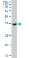 Testis Specific Serine Kinase 2 antibody, H00023617-M03, Novus Biologicals, Western Blot image 