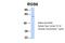 Regulator Of G Protein Signaling 6 antibody, 25-179, ProSci, Western Blot image 