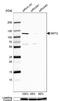 N-Myristoyltransferase 2 antibody, NBP1-85817, Novus Biologicals, Western Blot image 