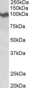 Makorin Ring Finger Protein 1 antibody, 42-850, ProSci, Western Blot image 