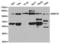 DNA Methyltransferase 3 Alpha antibody, LS-C192757, Lifespan Biosciences, Western Blot image 