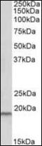 Serine Peptidase Inhibitor, Kunitz Type 2 antibody, orb137628, Biorbyt, Western Blot image 