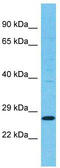 Tetraspanin 11 antibody, TA330800, Origene, Western Blot image 