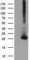 Glutathione S-Transferase Theta 2 (Gene/Pseudogene) antibody, TA501831, Origene, Western Blot image 