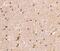 SWI/SNF Related, Matrix Associated, Actin Dependent Regulator Of Chromatin, Subfamily B, Member 1 antibody, MBS2521504, MyBioSource, Immunohistochemistry paraffin image 