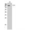 Fms Related Tyrosine Kinase 3 antibody, LS-C387715, Lifespan Biosciences, Western Blot image 