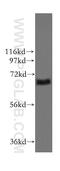 Integrin Alpha FG-GAP Repeat Containing 1 antibody, 11731-1-AP, Proteintech Group, Western Blot image 