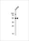AKT Serine/Threonine Kinase 3 antibody, 62-607, ProSci, Western Blot image 