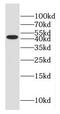 Glutamate-Ammonia Ligase antibody, FNab03505, FineTest, Western Blot image 