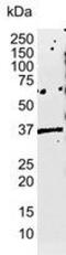 Major Histocompatibility Complex, Class I, E antibody, GTX75948, GeneTex, Western Blot image 