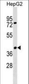 Sorting Nexin 32 antibody, LS-C159057, Lifespan Biosciences, Western Blot image 