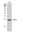 Eukaryotic Translation Initiation Factor 4E Family Member 3 antibody, PA5-50954, Invitrogen Antibodies, Western Blot image 