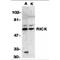 Receptor Interacting Serine/Threonine Kinase 2 antibody, MBS151211, MyBioSource, Western Blot image 