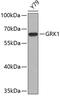 G Protein-Coupled Receptor Kinase 1 antibody, 22-268, ProSci, Western Blot image 