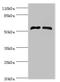 Cytochrome P450 Family 4 Subfamily F Member 11 antibody, orb351509, Biorbyt, Western Blot image 
