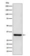 Paired Like Homeodomain 3 antibody, M03453, Boster Biological Technology, Western Blot image 