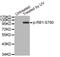 RB Transcriptional Corepressor 1 antibody, abx000491, Abbexa, Western Blot image 