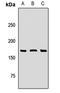 SOS Ras/Rac Guanine Nucleotide Exchange Factor 1 antibody, LS-C668208, Lifespan Biosciences, Western Blot image 