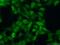 Rho GTPase Activating Protein 39 antibody, 10024-2-AP, Proteintech Group, Immunofluorescence image 