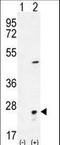 Visinin Like 1 antibody, LS-B9617, Lifespan Biosciences, Western Blot image 