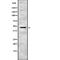 Inhibitor Of Growth Family Member 3 antibody, abx147415, Abbexa, Western Blot image 