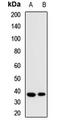 CD207 Molecule antibody, LS-B15833, Lifespan Biosciences, Western Blot image 