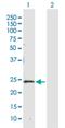 Carbonyl Reductase 4 antibody, H00084869-D01P, Novus Biologicals, Western Blot image 