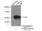 Aldehyde Dehydrogenase 1 Family Member A2 antibody, 13951-1-AP, Proteintech Group, Immunoprecipitation image 