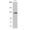 ATP Citrate Lyase antibody, LS-C382209, Lifespan Biosciences, Western Blot image 