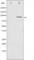 Inhibitor Of Nuclear Factor Kappa B Kinase Subunit Beta antibody, abx010975, Abbexa, Western Blot image 