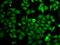 Inosine Monophosphate Dehydrogenase 2 antibody, GTX33264, GeneTex, Immunofluorescence image 