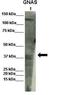 Guanine nucleotide-binding protein G(s) subunit alpha isoforms short antibody, orb330252, Biorbyt, Western Blot image 