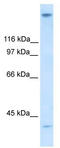 Zinc Finger Protein 318 antibody, TA330582, Origene, Western Blot image 