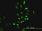 Cystathionine-Beta-Synthase antibody, H00000875-M07, Novus Biologicals, Immunocytochemistry image 