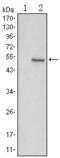 SUZ12 Polycomb Repressive Complex 2 Subunit antibody, STJ98404, St John