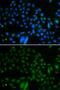 AlkB Homolog 8, TRNA Methyltransferase antibody, GTX65809, GeneTex, Immunocytochemistry image 