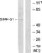 Signal Regulatory Protein Alpha antibody, LS-B7618, Lifespan Biosciences, Western Blot image 