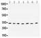 Cyclin D1 antibody, PA1245-2, Boster Biological Technology, Western Blot image 