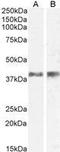 Interleukin 12B antibody, GTX88847, GeneTex, Western Blot image 