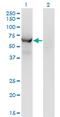 Chaperonin Containing TCP1 Subunit 8 Like 2 antibody, MA5-23095, Invitrogen Antibodies, Western Blot image 