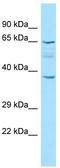 Keratin 77 antibody, TA331266, Origene, Western Blot image 