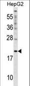 Cytoglobin antibody, LS-C167204, Lifespan Biosciences, Western Blot image 