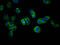 ATP Binding Cassette Subfamily G Member 5 antibody, LS-C672711, Lifespan Biosciences, Immunofluorescence image 
